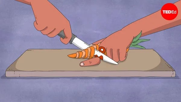 Fingers Crossed: The Unseen Realities of Losing—And Saving—A Severed Finger Cover