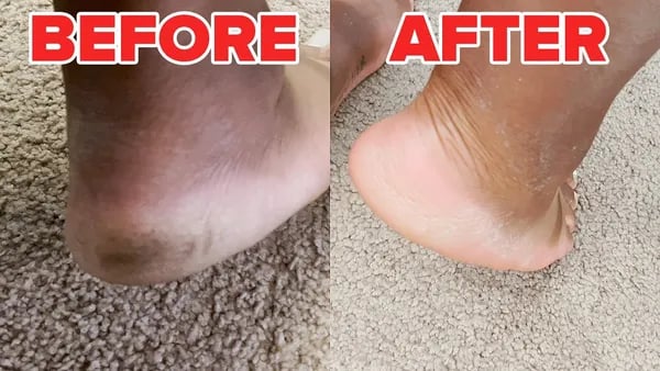 I Tested a Viral Foot Peeling Mask: Soft Feet or Satisfying Fail? Cover